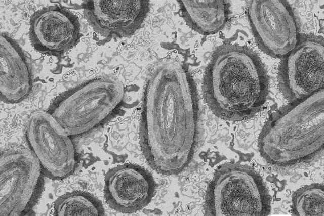 gumboro disease vaccine